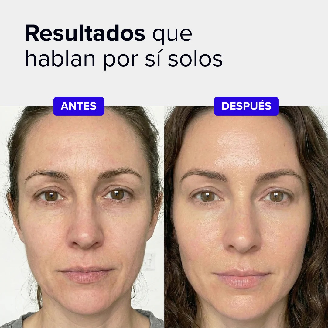 Beautybacs - Image 4