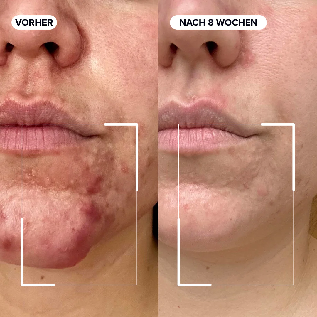Skin & Glow Duo - Image 3